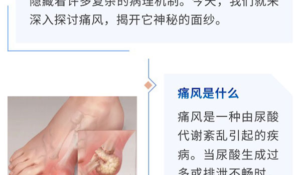 “痛” 定思痛，，，，，，相识痛风的真相-新闻资讯-江苏森纳医疗科技有限公司